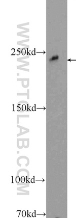 MAPKBP1 Antibody in Western Blot (WB)