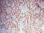 ANT1/2 Antibody in Immunohistochemistry (Paraffin) (IHC (P))