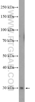 ANT1/2 Antibody in Western Blot (WB)