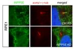 INPP5E Antibody in Immunocytochemistry (ICC/IF)