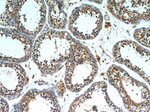 INPP5E Antibody in Immunohistochemistry (Paraffin) (IHC (P))