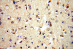 INPP5E Antibody in Immunohistochemistry (Paraffin) (IHC (P))