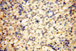 INPP5E Antibody in Immunohistochemistry (Paraffin) (IHC (P))