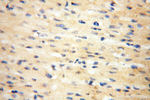 INPP5E Antibody in Immunohistochemistry (Paraffin) (IHC (P))