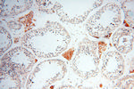 INPP5E Antibody in Immunohistochemistry (Paraffin) (IHC (P))