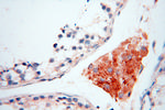 INPP5E Antibody in Immunohistochemistry (Paraffin) (IHC (P))