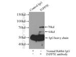 INPP5E Antibody in Immunoprecipitation (IP)