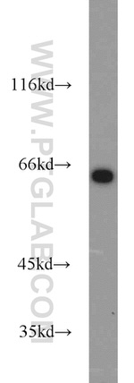 INPP5E Antibody in Western Blot (WB)