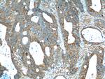 PTK7 Antibody in Immunohistochemistry (Paraffin) (IHC (P))