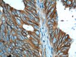 PTK7 Antibody in Immunohistochemistry (Paraffin) (IHC (P))