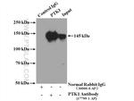 PTK7 Antibody in Immunoprecipitation (IP)