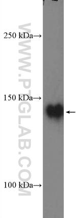 PTK7 Antibody in Western Blot (WB)