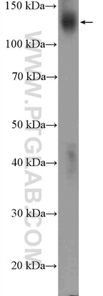 PTK7 Antibody in Western Blot (WB)