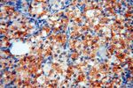 Calumenin Antibody in Immunohistochemistry (Paraffin) (IHC (P))