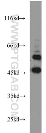 Calumenin Antibody in Western Blot (WB)