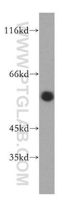Calumenin Antibody in Western Blot (WB)