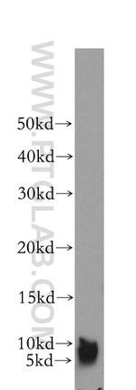 SERP1 Antibody in Western Blot (WB)