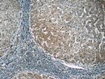 PGK1 Antibody in Immunohistochemistry (Paraffin) (IHC (P))