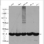 PGK1 Antibody in Western Blot (WB)