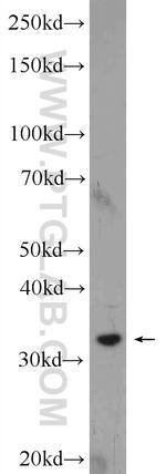 Syntaxin 17 Antibody in Western Blot (WB)