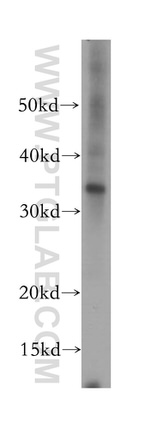 Syntaxin 17 Antibody in Western Blot (WB)