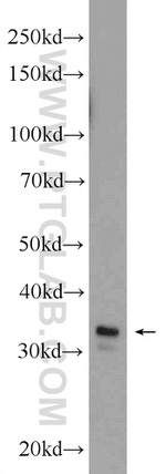 Syntaxin 17 Antibody in Western Blot (WB)