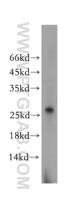 RABL2A Antibody in Western Blot (WB)