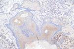 RAB27A Antibody in Immunohistochemistry (Paraffin) (IHC (P))