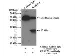 RAB27A Antibody in Immunoprecipitation (IP)