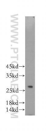 RAB27A Antibody in Western Blot (WB)