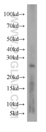 RAB27A Antibody in Western Blot (WB)