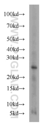 RAB27A Antibody in Western Blot (WB)