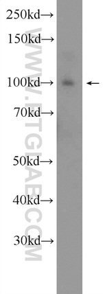 SNCAIP Antibody in Western Blot (WB)