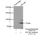 SNCAIP Antibody in Immunoprecipitation (IP)