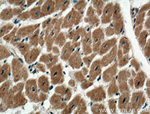 CACNA1G Antibody in Immunohistochemistry (Paraffin) (IHC (P))