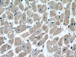 RAB1B Antibody in Immunohistochemistry (Paraffin) (IHC (P))