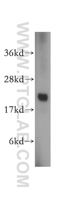 RAB1B Antibody in Western Blot (WB)