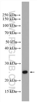 RAB1B Antibody in Western Blot (WB)