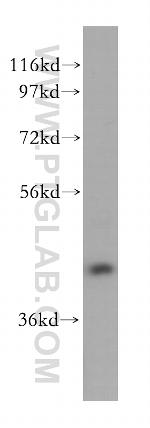 RAB3IL1 Antibody in Western Blot (WB)