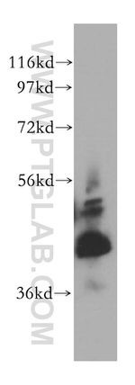 RAB3IL1 Antibody in Western Blot (WB)