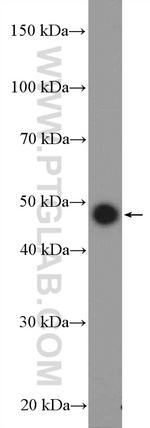 UCHL5IP Antibody in Western Blot (WB)