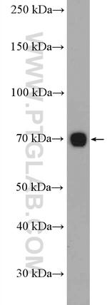 CD226 Antibody in Western Blot (WB)