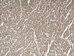 P2RX3 Antibody in Immunohistochemistry (Paraffin) (IHC (P))