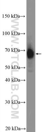 P2RX3 Antibody in Western Blot (WB)