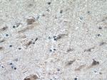 CHRNB2 Antibody in Immunohistochemistry (Paraffin) (IHC (P))