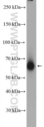 CHRNB2 Antibody in Western Blot (WB)