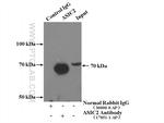 ASIC2 Antibody in Immunoprecipitation (IP)