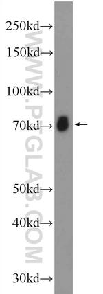 ASIC2 Antibody in Western Blot (WB)