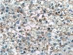 TNFSF8 Antibody in Immunohistochemistry (Paraffin) (IHC (P))