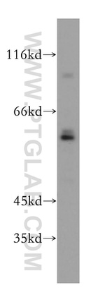 RFTN2 Antibody in Western Blot (WB)